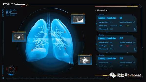 专访视见科技CEO陈浩：“做人工智能医疗的长跑者”(图1)