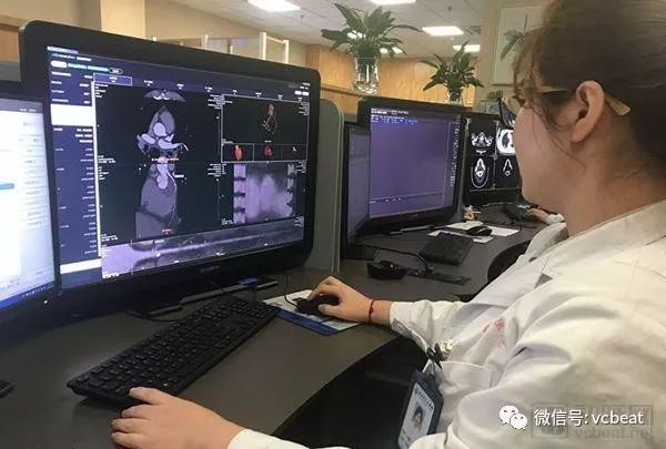已进流程,还是心血管!数坤AI探明行业路径?(图3) 已进流程,还是心血管!数坤AI探明行业路径?(图3)