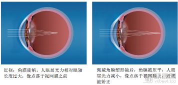 图片2作用原理.png