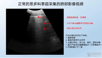 新冠疫情全球肆虐,掌上超声成为医生“第三双眼睛”(图1) 微信截图_20200525195308.png