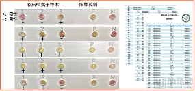 北航、华西医院联手:2周研发,5个月成型便捷式病原体核酸快速检测仪(图4) 4_副本.png