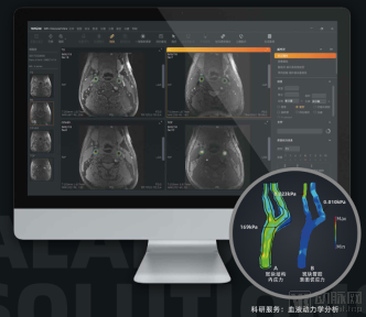 景三科技用硬核技术打造心脑血管影像分析智慧平台(图2) 微信截图_20200818140200.png