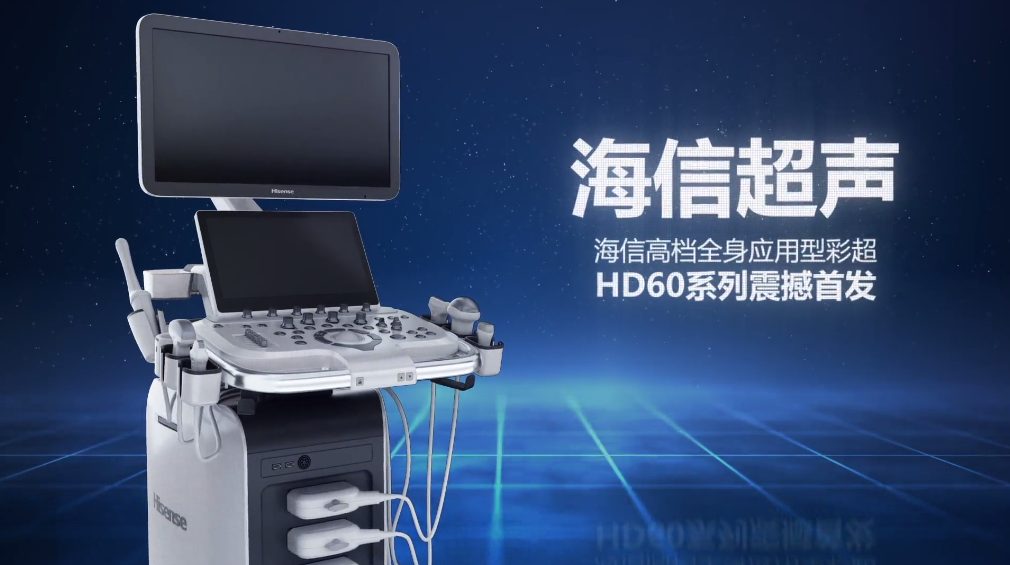 海信发布超声产品，填补高端医疗影像市场“关键一环”(图1)