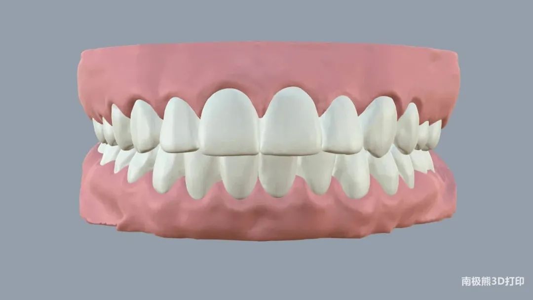 ArchForm宣布开设自己的3D打印矫正器工厂(图3)