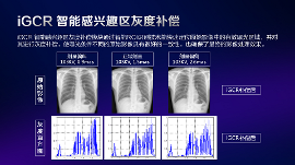 数字化X线摄影未来趋势之超低剂量化 数字化X线摄影未来趋势之超低剂量化
