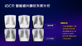 数字化X线摄影未来趋势之超低剂量化 数字化X线摄影未来趋势之超低剂量化