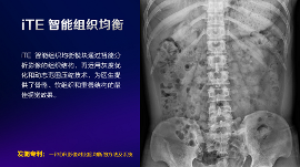 数字化X线摄影未来趋势之超低剂量化 数字化X线摄影未来趋势之超低剂量化