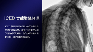 数字化X线摄影未来趋势之超低剂量化 数字化X线摄影未来趋势之超低剂量化