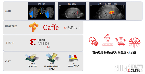 你知道在医疗设备中,FPGA扮演什么角色吗?(图7) 你知道在医疗设备中,FPGA扮演什么角色吗?(图7)