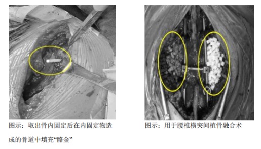 植入性医疗高值耗材企业奥精医疗科创板上市(图2)