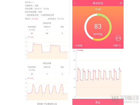 产后康复设备行业家庭化与全场景融合趋势凸显(图1) 22_副本.png