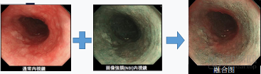 影像融合.png