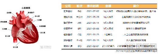 神经介入持续火爆,全球高值耗材价值趋势报告2010-2021年H1(图8) 7.png