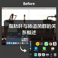脂肪肝与肠道菌群的关系概述(图4) 脂肪肝与肠道菌群的关系概述(图4)