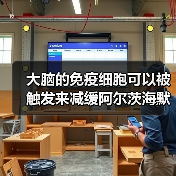 大脑的免疫细胞可以被触发来减缓阿尔茨海默病(图1) 大脑的免疫细胞可以被触发来减缓阿尔茨海默病(图1)