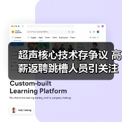 超声核心技术存争议 高薪返聘跳槽人员引关注(图4) 超声核心技术存争议 高薪返聘跳槽人员引关注(图4)